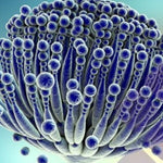 Mold Mycotoxin (11 common mycotoxins)